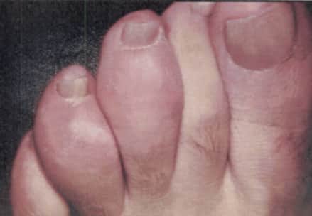 Descripción de la imagen